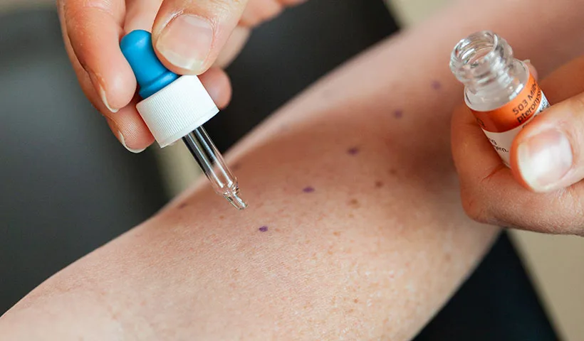 Allergietest am Unterarm: Pricktest mit Testlösungen
